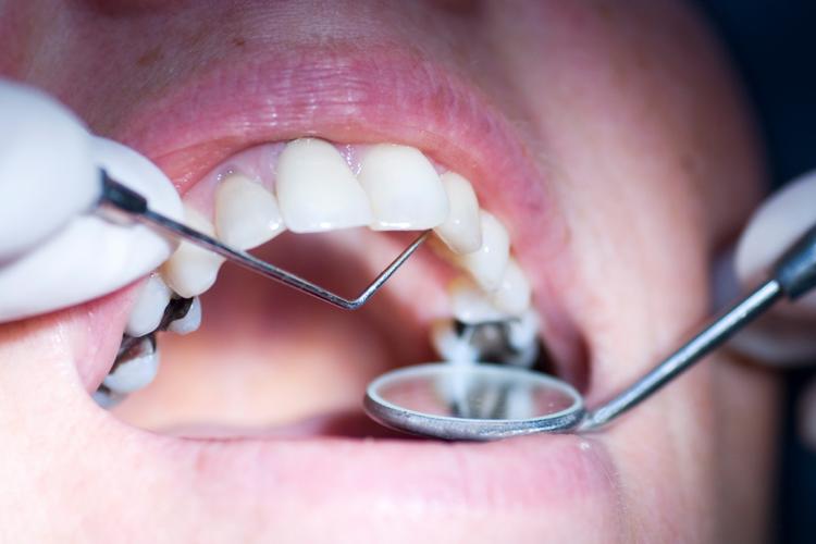 Комплексное обследование зубов Dental Check-Up